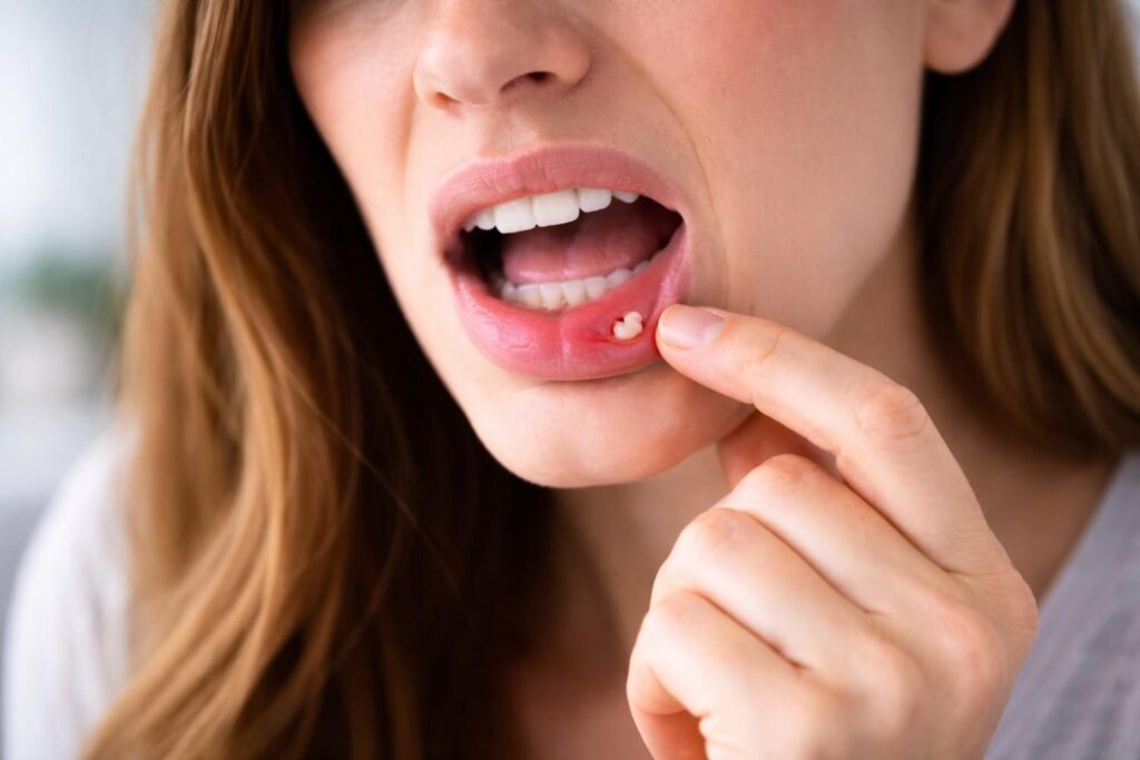 Sores or spots remain in place too long