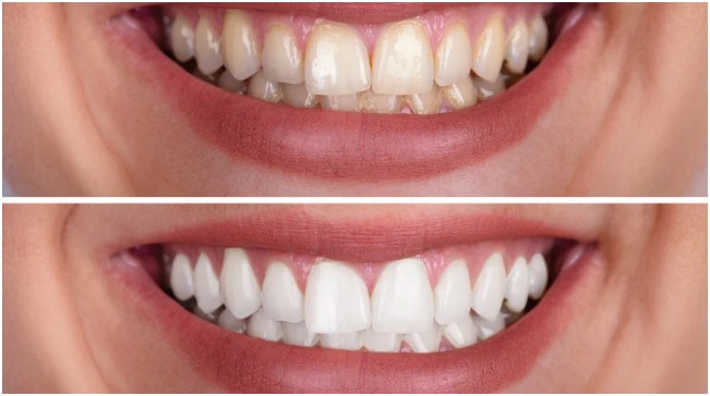 Cosmetic Dentistry for Enhancing Your Smile