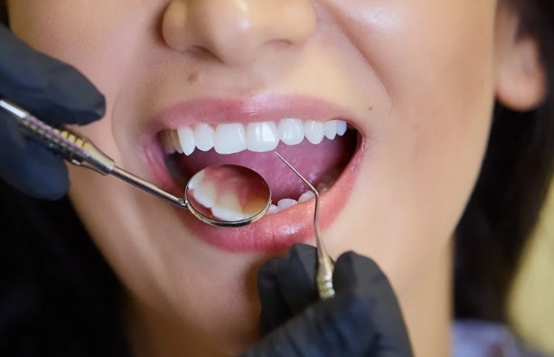Reasons Why Routine Dental Visits Matter